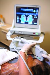 ULTHERAPY